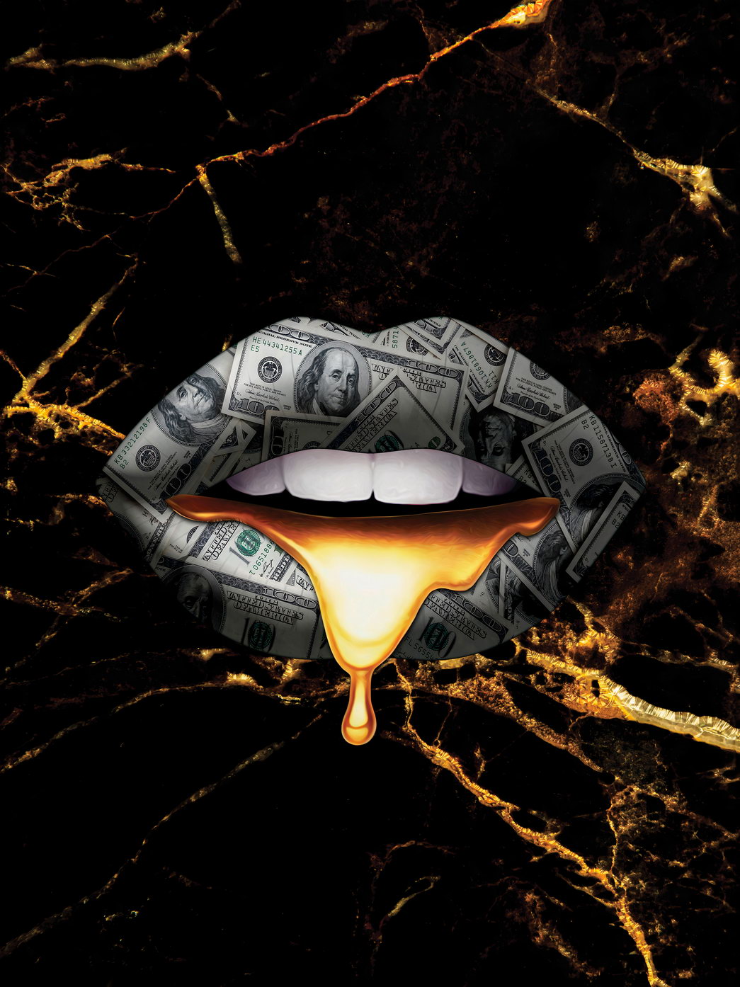 Black and Gold Lips Art Poster Luxury Wall Decor Bold Artistic Modern Pop Art Style Wall Print - xonomax