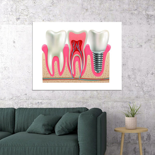 Dental Anatomy Art Poster Educational Tooth Structure Wall Decor Modern Artistic Design Medical Wall Print - xonomax